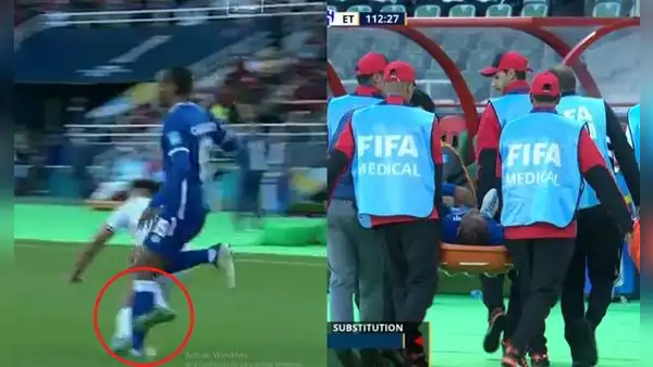 André Carrillo se retiró en camilla tras dura lesión en el Mundial de Clubes