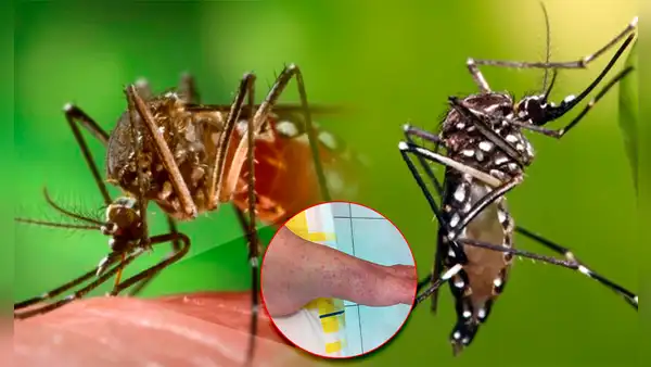 ¿Cómo se transmite la chikungunya y cuáles son los signos de alarma, según la OMS?