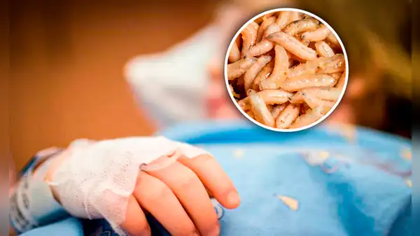 Niña de 4 años fue llevada al hospital y le extrajeron más de 100 gusanos de su cabeza