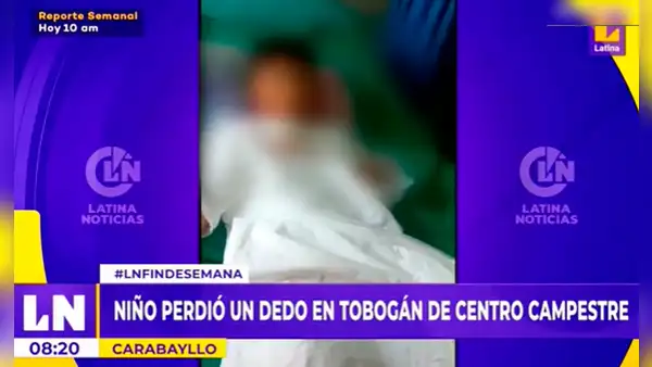 Carabayllo: niño perdió un dedo mientras jugaba en un tobogán de centro campestre