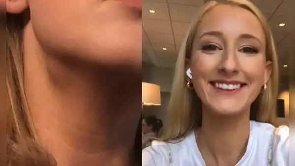 Joven descubre que tiene cáncer en etapa 4 después de realizar truco de belleza viral de TikTok