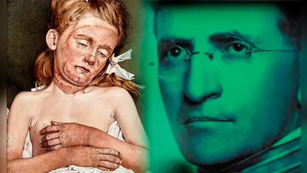 Joseph Goldberger, el doctor que comió heces de sus pacientes y nos salvó de una terrible epidemia
