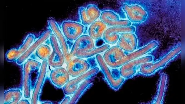 Guinea Ecuatorial declara alerta sanitaria tras confirmar 9 fallecidos por un virus similar al ébola