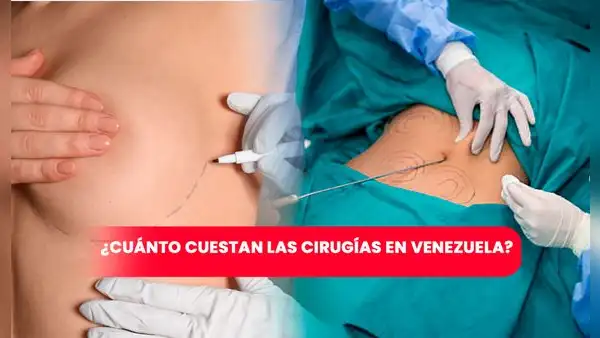 Aumento de senos, lipoescultura y otras cirugías plásticas: ¿cuánto cuestan en Venezuela?