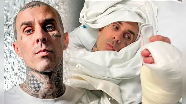 Travis Barker de Blink-182 tras cirugía en su dedo: "Fue un éxito, seguiré haciendo lo que me gusta"