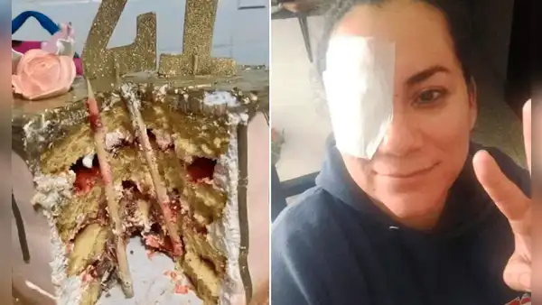 ¡Por poco se queda ciega! Hunden el rostro de mujer en pastel y termina con palo incrustado en el ojo