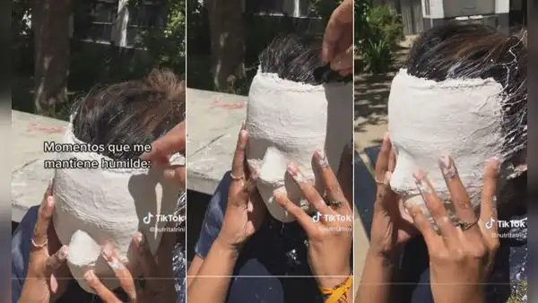 Joven queda con el yeso pegado a sus pestañas y se aterra al quitárselo