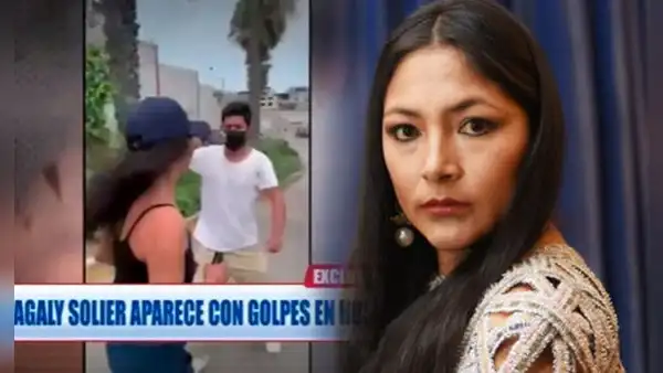 Magaly Solier preocupa a fans tras ser captada en hospital con moretón en el rostro