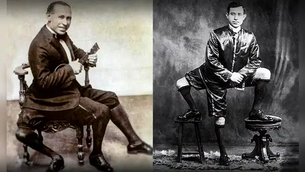 Frank Lentini, el 'maraviglioso': la estrella de circo con 16 dedos, 4 pies, 3 piernas y 2 penes