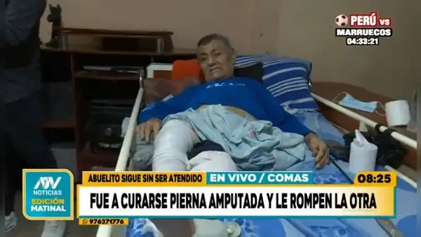 Comas: adulto mayor es maltratado por el mismo policlínico en donde le fracturaron pierna