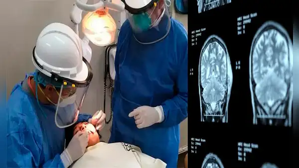 ¿Por qué cepillarse los dientes podría ser clave para prevenir el alzhéimer?
