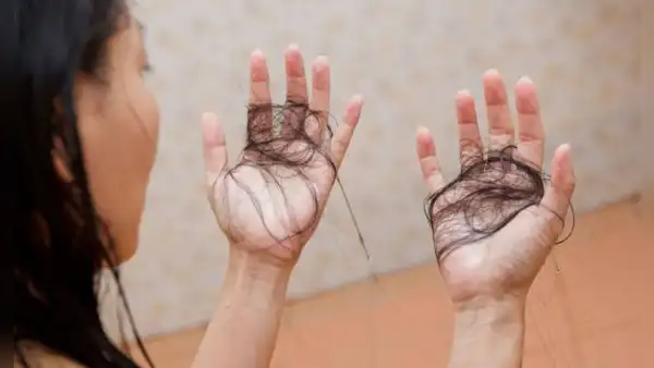 ¿Por qué se me cae mucho el cabello cuando me baño y cómo solucionarlo?