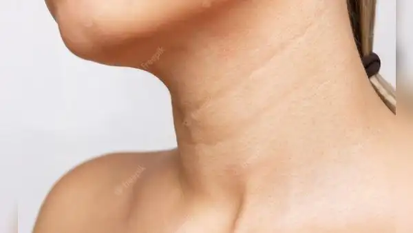 ¿Por qué aparecen líneas en el cuello y cómo atenuarlas?