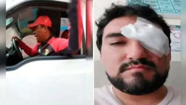 Ate: hombre casi pierde la vista tras ser atacado por un entrenador de fútbol de menores
