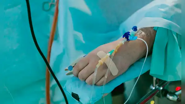 Nuevo medicamento evita efectos secundarios de quimioterapia en cáncer de colon