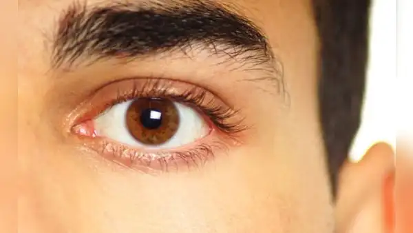 ¿Por qué late mi ojo y cuán peligroso es para mi salud?