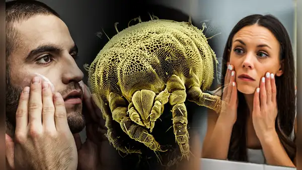 ¿Cómo son los ácaros que viven en nuestra cara? Ahí comen y se reproducen