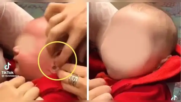 Bebé sordo escucha por primera vez y su reacción conmueve a más de uno: “Me hizo llorar”