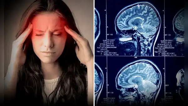 Pensó que tenía un simple dolor de cabeza, pero va al hospital y le detectan un tumor cerebral