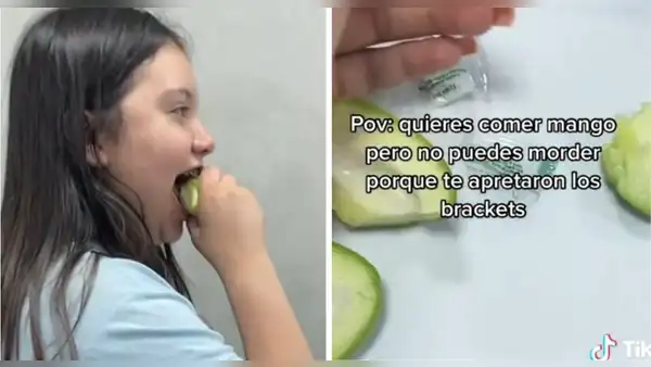 Joven le da fruta masticada a su amiga porque le ajustaron los brackets: "Amistades que valen"