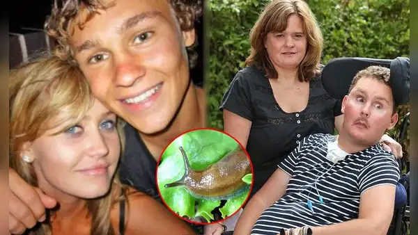 Prometedor deportista comió una babosa por reto entre amigos, quedó vegetal por años y murió