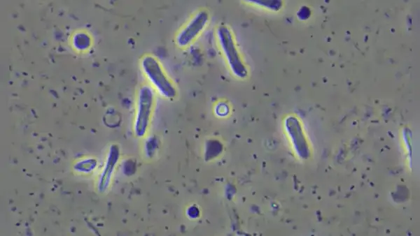 Nubes transportan bacterias resistentes a los antibióticos, según estudio