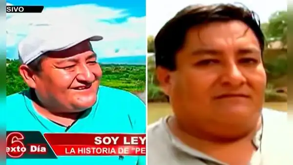 'Pepito Dos Cañones': la impactante historia del único hombre peruano que nació con 2 penes