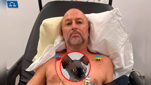 La historia de Chris Rowley: ¿cómo el tropezarse con su gato lo dejó al borde de la muerte?