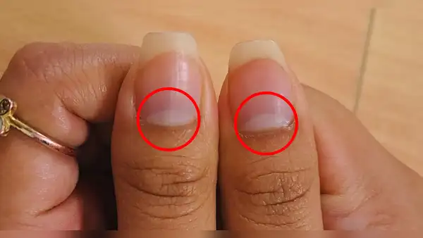 ¿Qué es la lúnula de las uñas y por qué no todos lo tienen?
