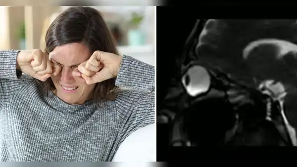 ¿Te frotas los ojos habitualmente? Conoce los efectos nocivos que podría tener en tu salud, según expertos