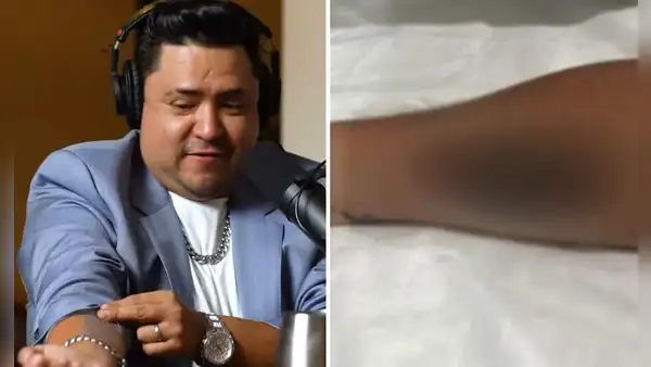 Lucho Cuéllar se hizo tatuaje en honor al Grupo 5 y reaccionan: "Ni Christian Yaipén"