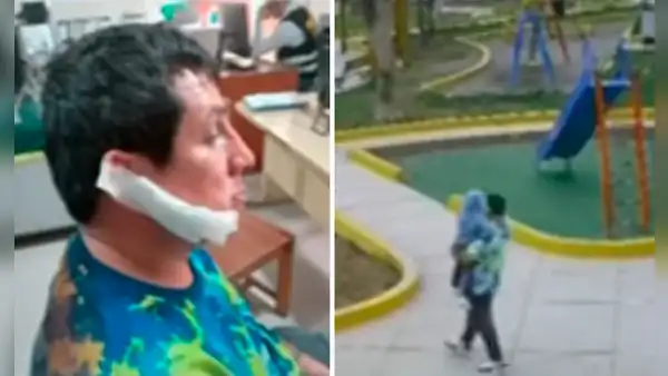 SJM: mujer desfigura rostro de expareja tras citarlo para hablar sobre su hija