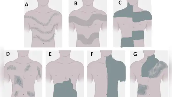 Los 'tatuajes' invisibles que posee cada persona desde el nacimiento: ¿cómo podemos verlos?