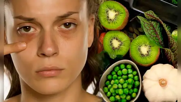 ¡Dile adiós a las ojeras! Esta es la VITAMINA que debes tomar para eliminarlas para siempre