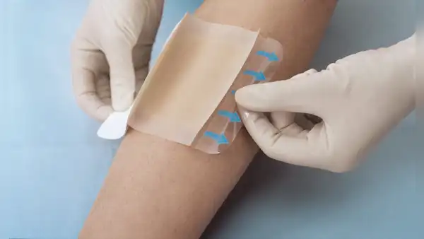 Científicos chinos crean parche que cambia de color ante infecciones por superbacterias