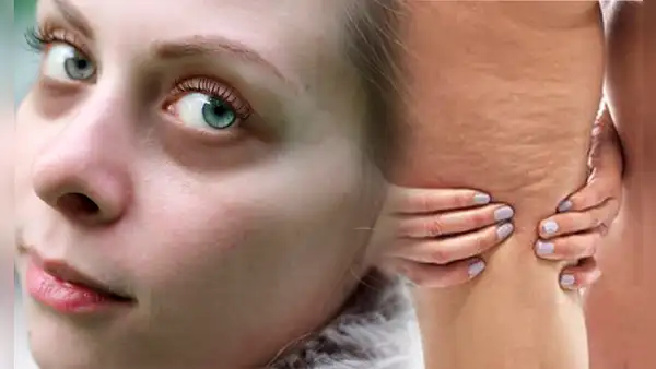 Mejora la apariencia de tus ojeras y reduce la celulitis con esta VITAMINA natural