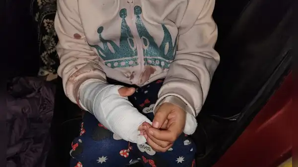 Chorrillos: 2 niños quedan gravemente heridos tras balacera cuando iban a bodega