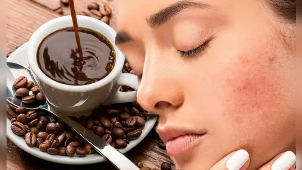 ¿Por qué se dice que tomar café en exceso es malo para la piel? Conoce las consecuencias