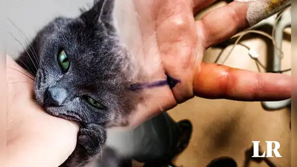 Hombre mordido por gato callejero contrae una infección desconocida para la ciencia
