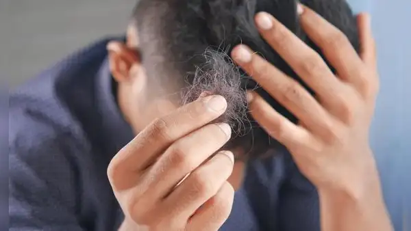 ¿Por qué se nos cae el cabello a pesar de ser jóvenes?