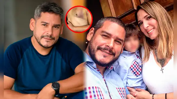Guillermo Suárez: ¿qué se sabe de la salud del fotógrafo venezolano atropellado en Caracas?