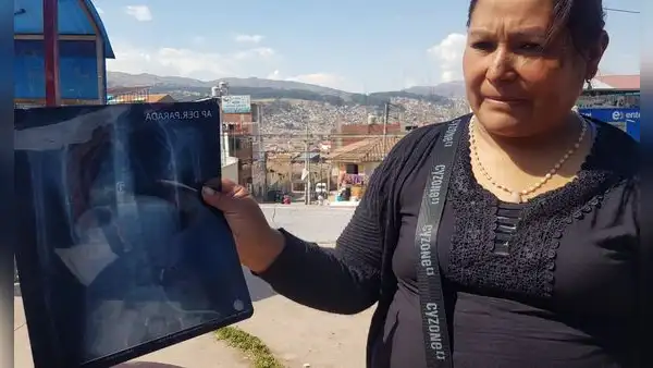 Madre denuncia bullying después de que su hija sea hospitalizada tras ingerir grapa en colegio de Cusco