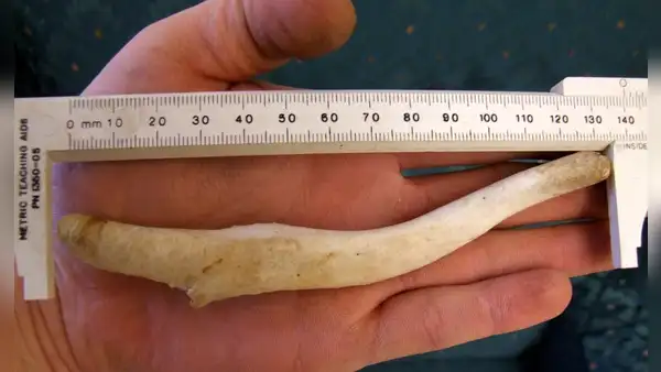 ¿Por qué los hombres perdieron el hueso del pene cuando evolucionaron?