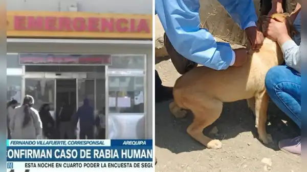 Arequipa: mujer que contrajo rabia humana se encuentra en UCI y con respirador artificial