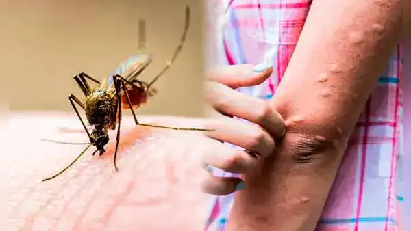 ¿Por qué hay tantos mosquitos en Arequipa y qué hacer para protegernos de ellos?