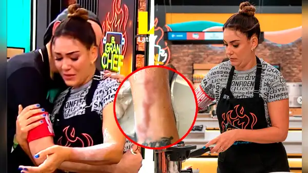 Tilsa Lozano sufre fuerte quemadura de segundo grado en 'El gran chef: famosos'