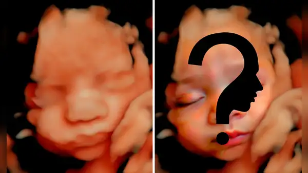 Usan tecnología de IA en ecografías de bebés para adivinar cómo serán sus rostros al nacer