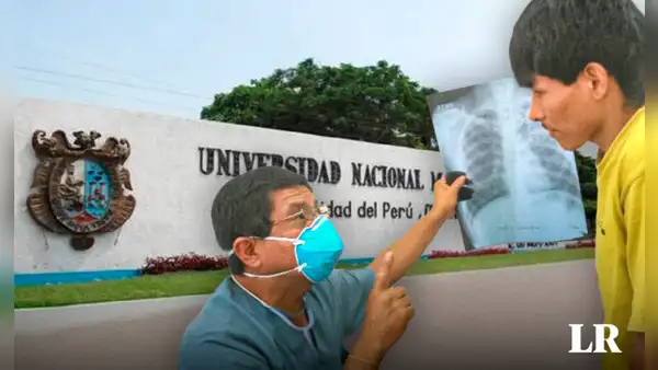 Brote de TBC en San Marcos pone en alerta a estudiantes y autoridades universitarias