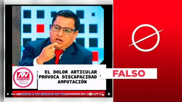 Ministro de Salud no impulsa en TV "crema curativa" contra el dolor articular: el video es falso