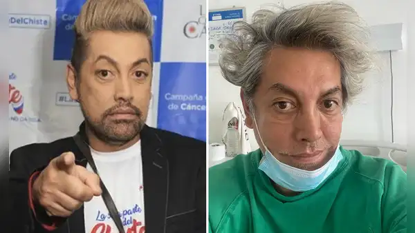 Koky Belaunde sobrevivió a dificil operación de riesgo: ¿qué pasó con el famoso maquillador?